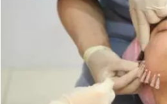 私密埋线有啥作用,重塑私密之美，焕发女性自信风采